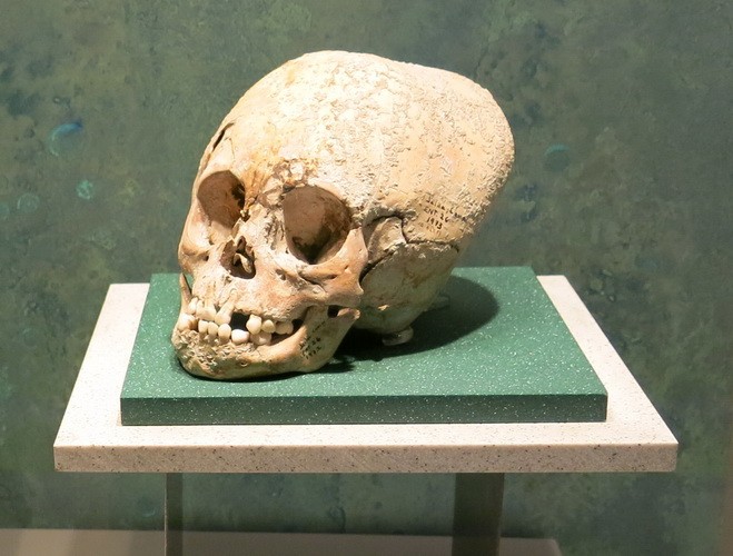 The history of the Maya: skull deformations
